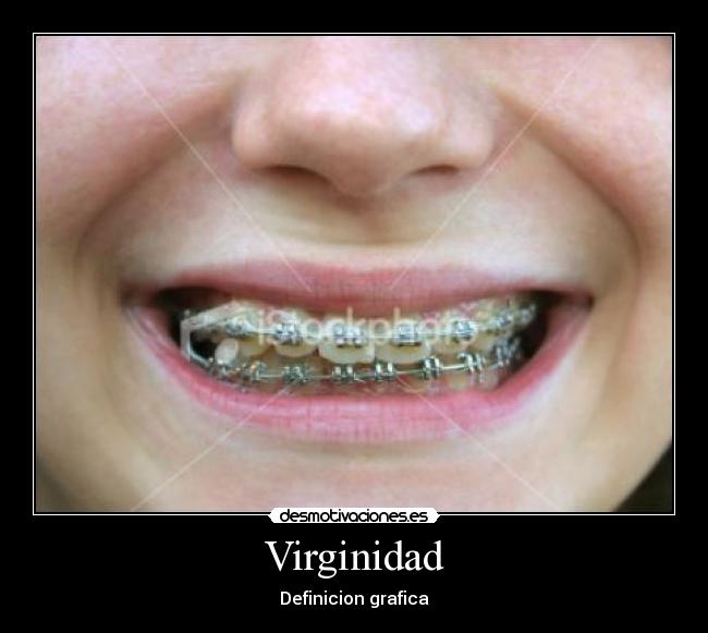 Virginidad -