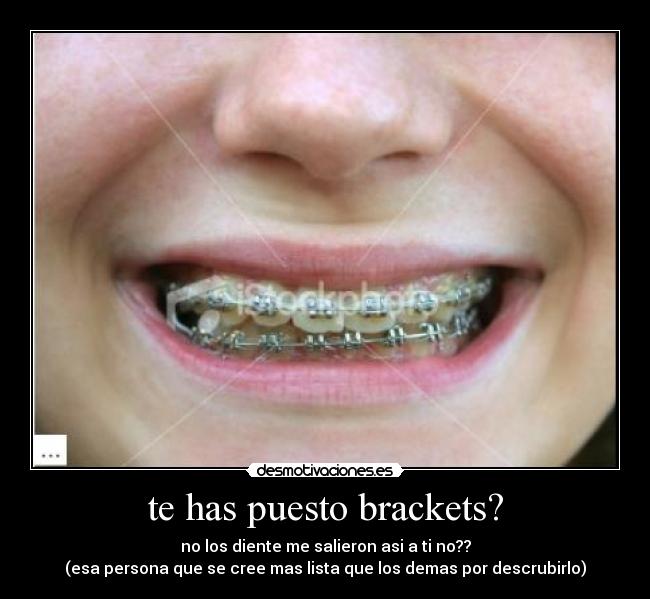 te has puesto brackets? - no los diente me salieron asi a ti no??
(esa persona que se cree mas lista que los demas por descrubirlo)