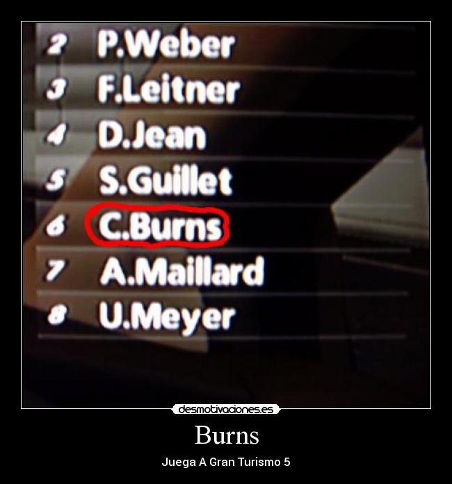 Burns - 