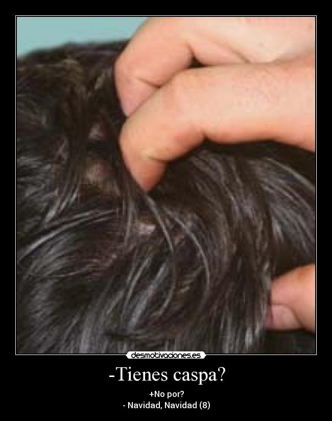 -Tienes caspa? - +No por?
- Navidad, Navidad (8)