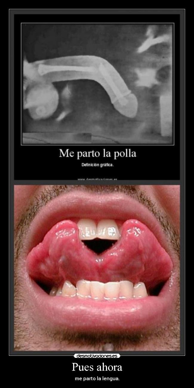Pues ahora - me parto la lengua.