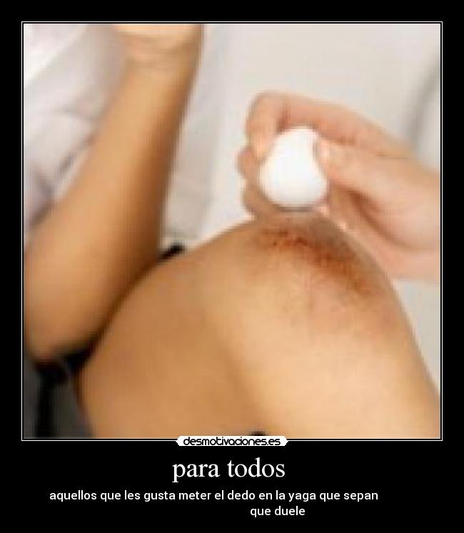 para todos - aquellos que les gusta meter el dedo en la yaga que sepan
que duele
