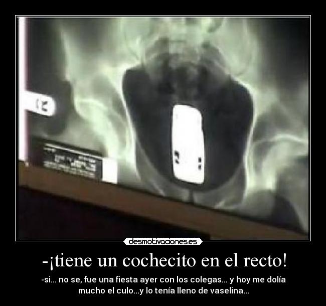 -¡tiene un cochecito en el recto! - 