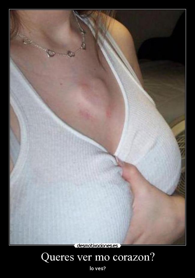 Queres ver mo corazon? -