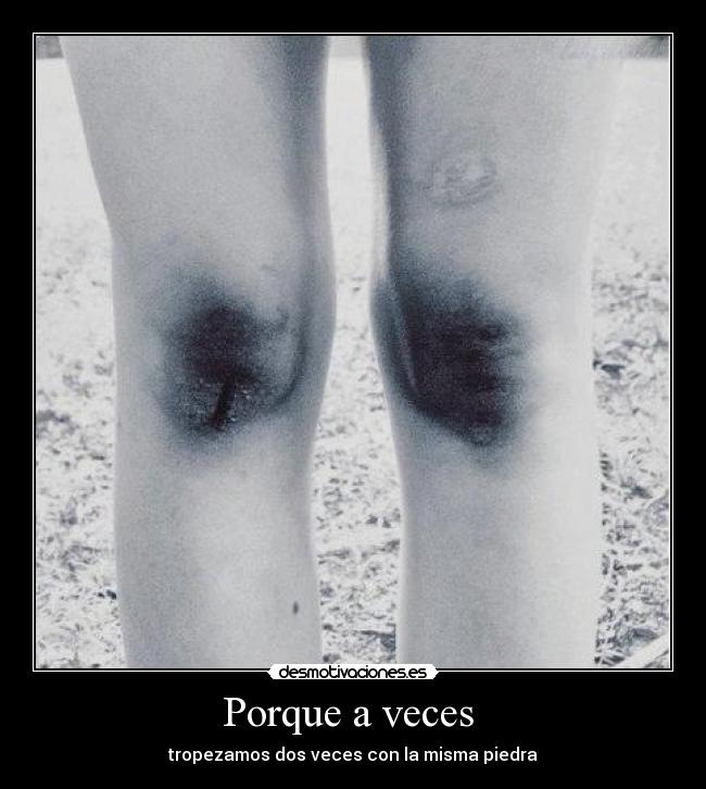 Porque a veces  - tropezamos dos veces con la misma piedra