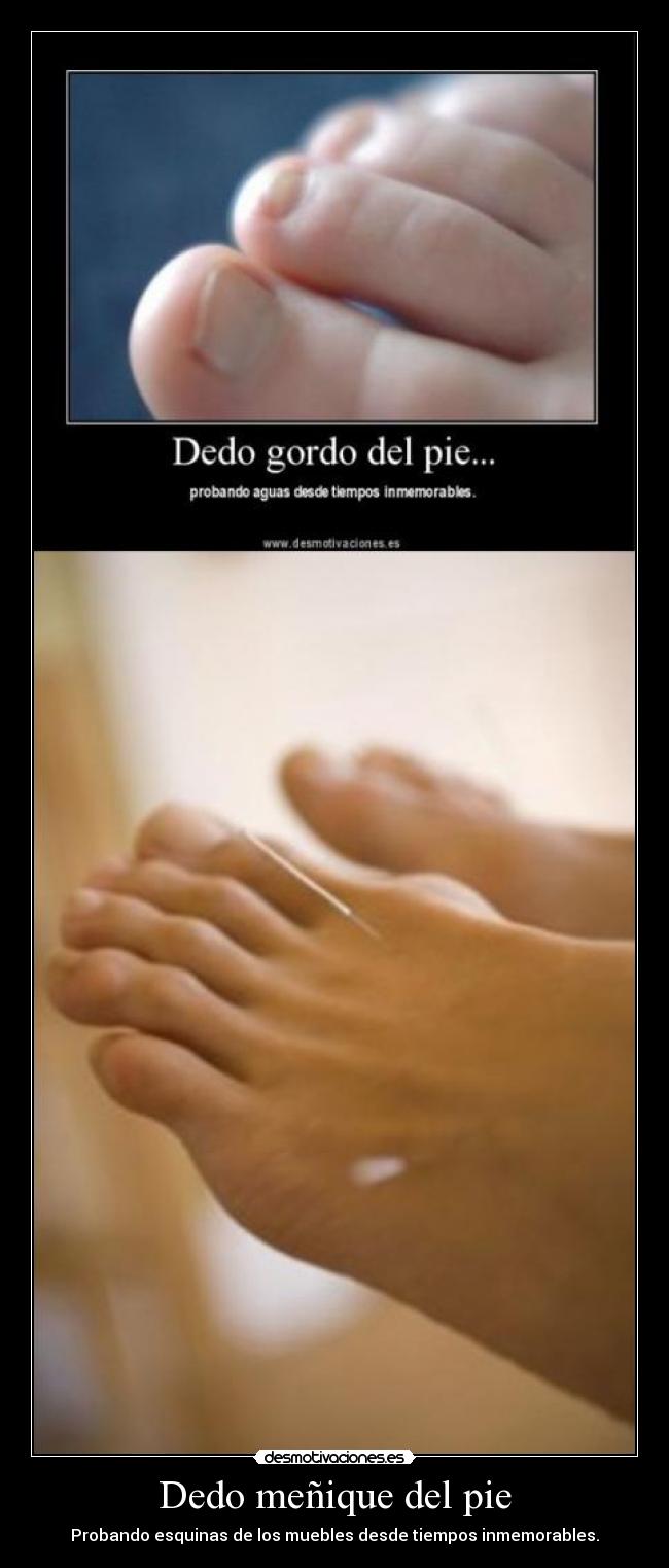 Dedo meñique del pie - 