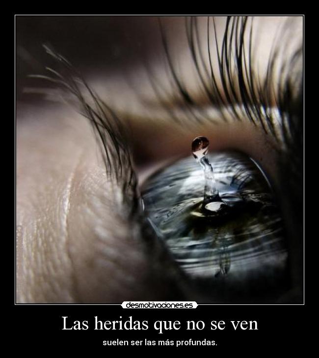Las heridas que no se ven - suelen ser las más profundas.