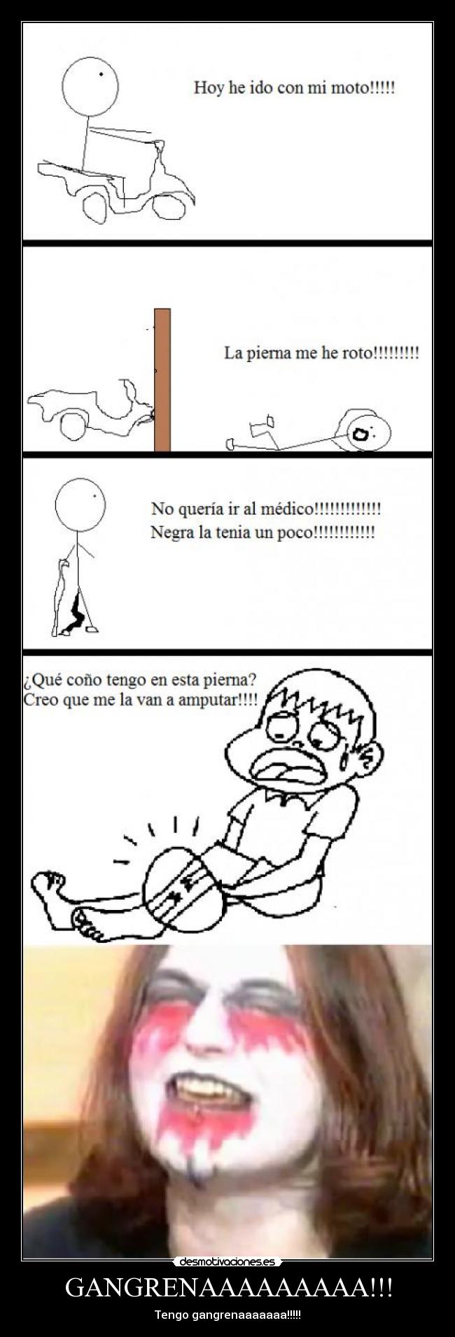 GANGRENAAAAAAAAA!!! -