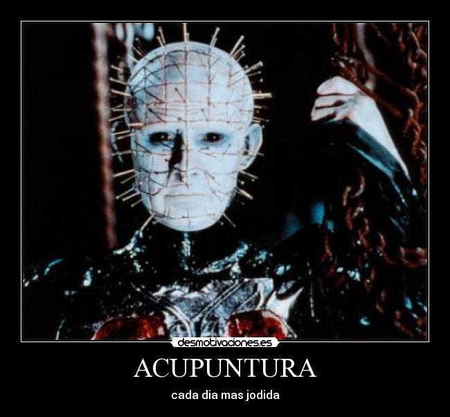 ACUPUNTURA - cada dia mas jodida