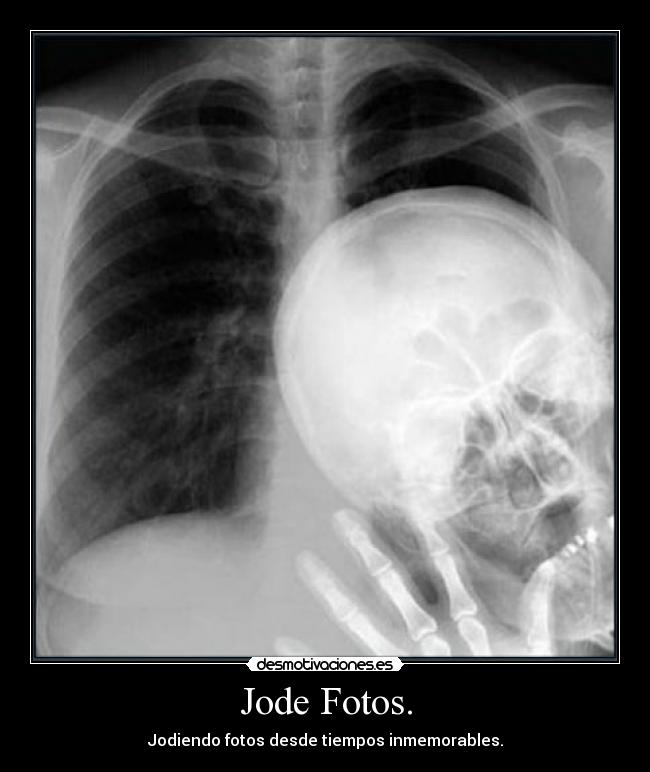 Jode Fotos. - Jodiendo fotos desde tiempos inmemorables.