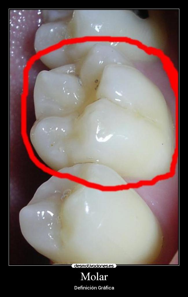 Molar -