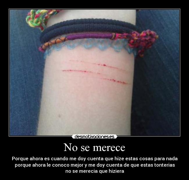 No se merece - 