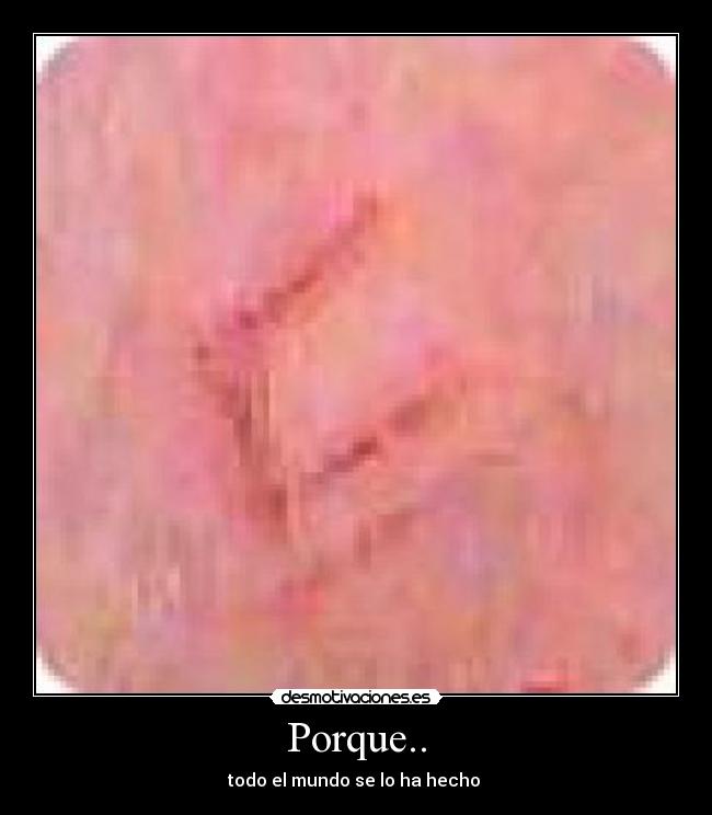 Porque.. -