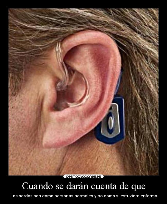 Cuando se darán cuenta de que - Los sordos son como personas normales y no como si estuviera enfermo