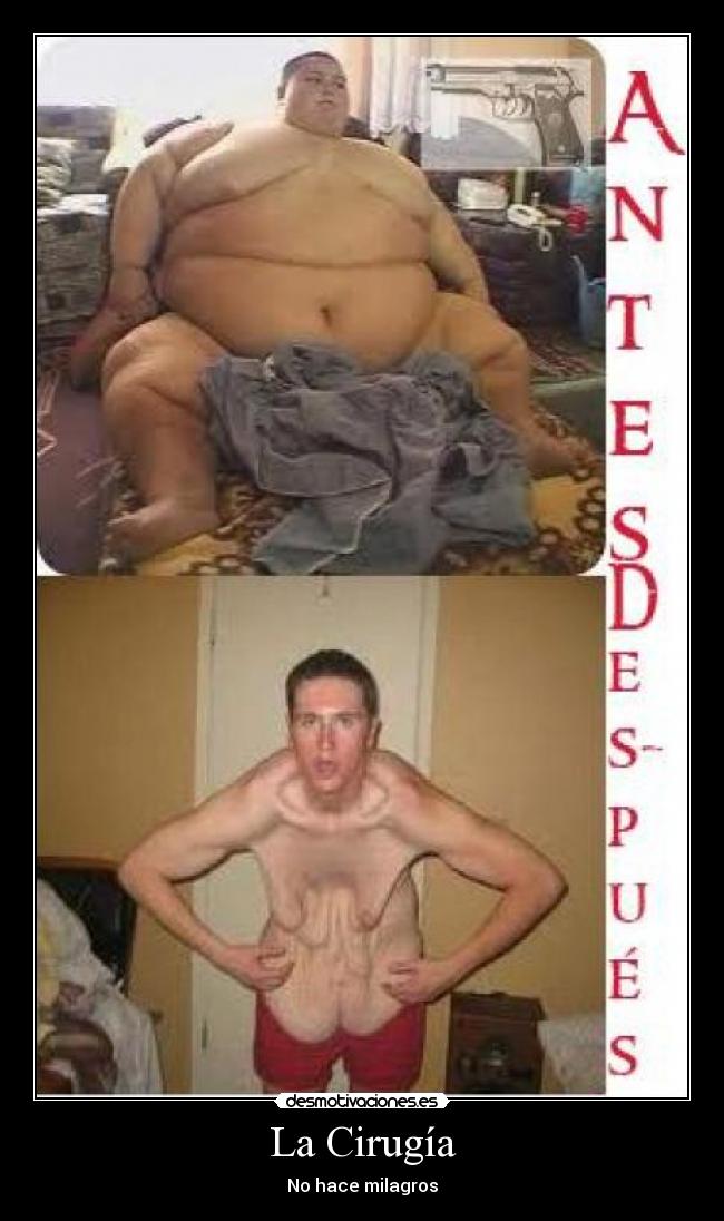 La Cirugía - No hace milagros