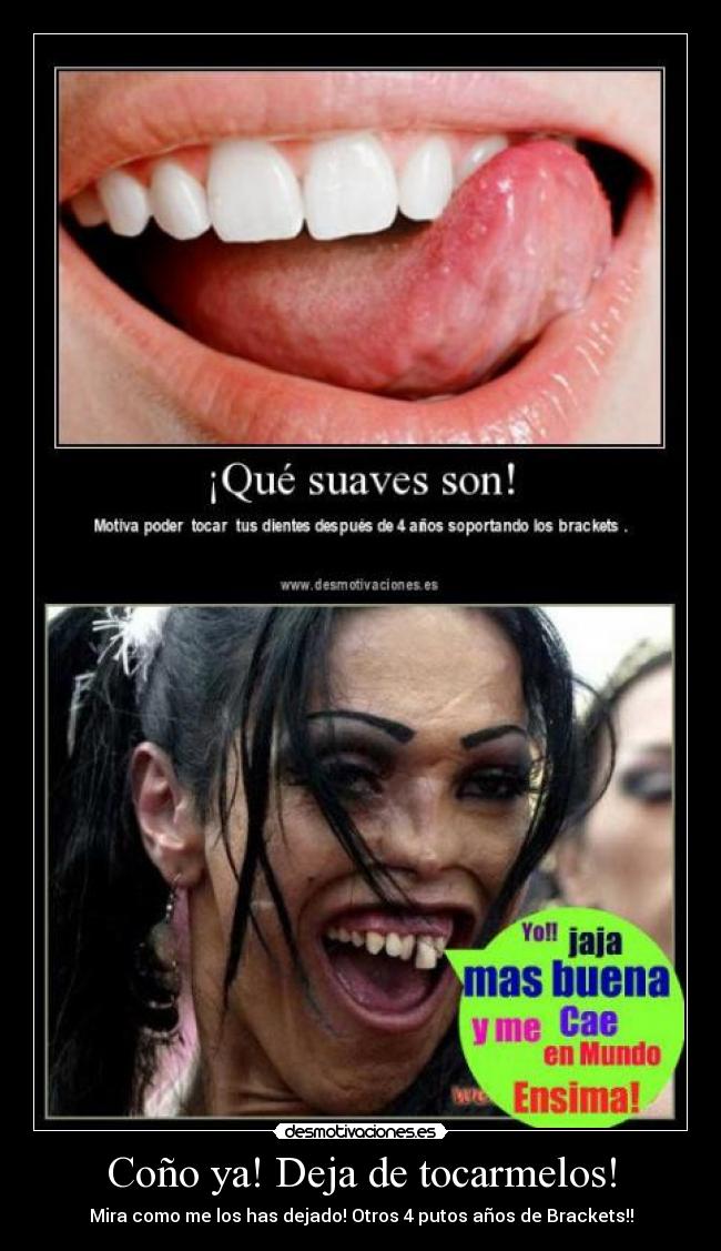 Coño ya! Deja de tocarmelos! - Mira como me los has dejado! Otros 4 putos años de Brackets!!