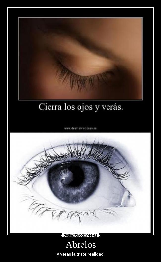 Abrelos - y veras la triste realidad.