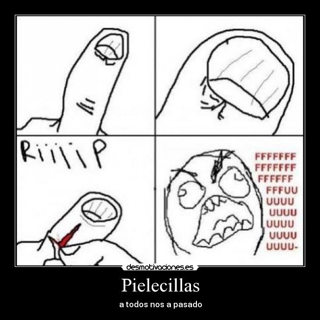 Pielecillas - a todos nos a pasado
