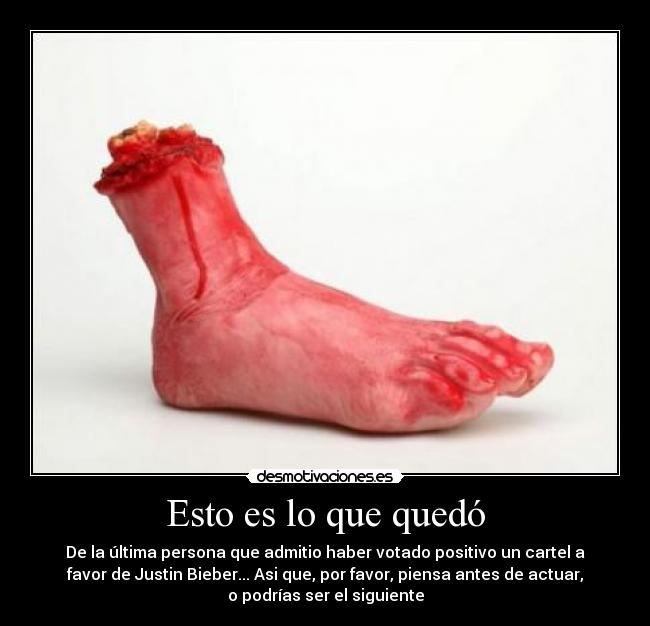 Esto es lo que quedó - 