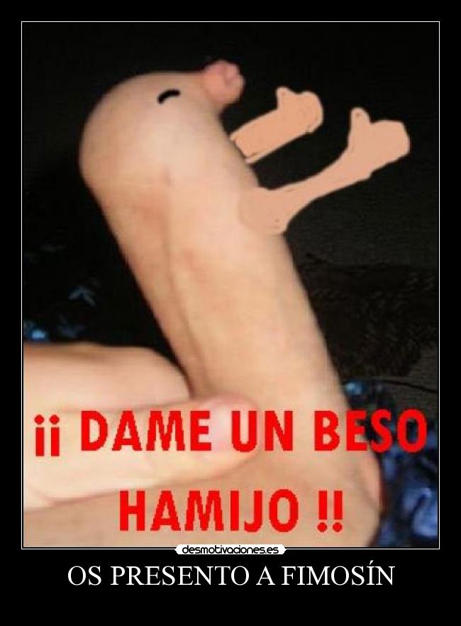 OS PRESENTO A FIMOSÍN -