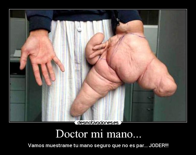 Doctor mi mano... - Vamos muestrame tu mano seguro que no es par... JODER!!!