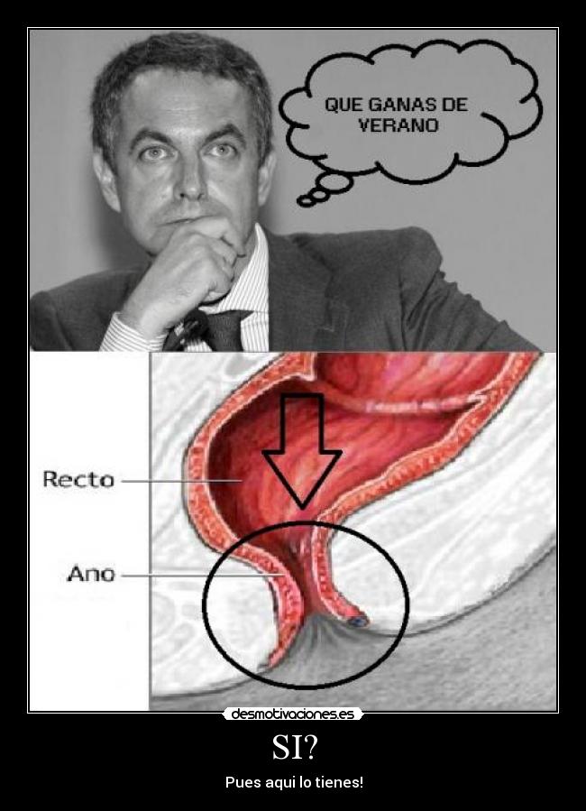 SI? - Pues aqui lo tienes!