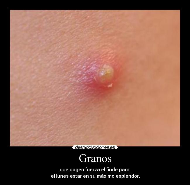 Granos -