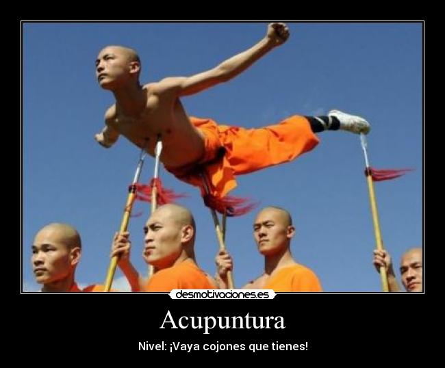 Acupuntura -