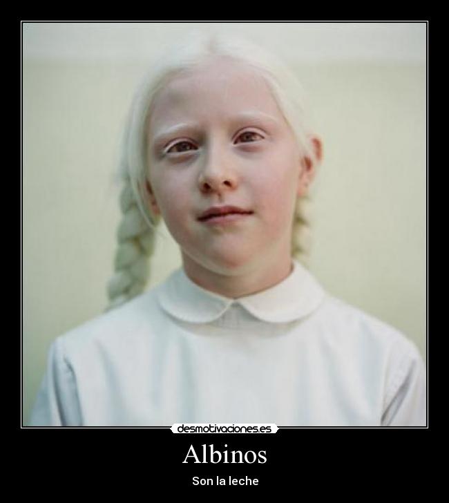 Albinos -
