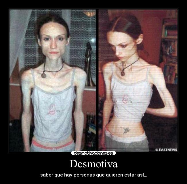Desmotiva - saber que hay personas que quieren estar así...