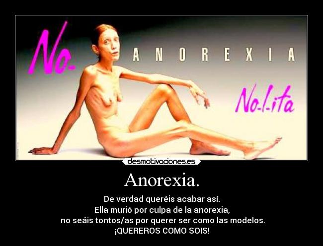 Anorexia. - 