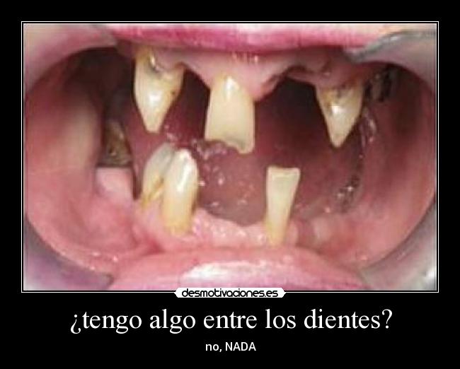 ¿tengo algo entre los dientes? -