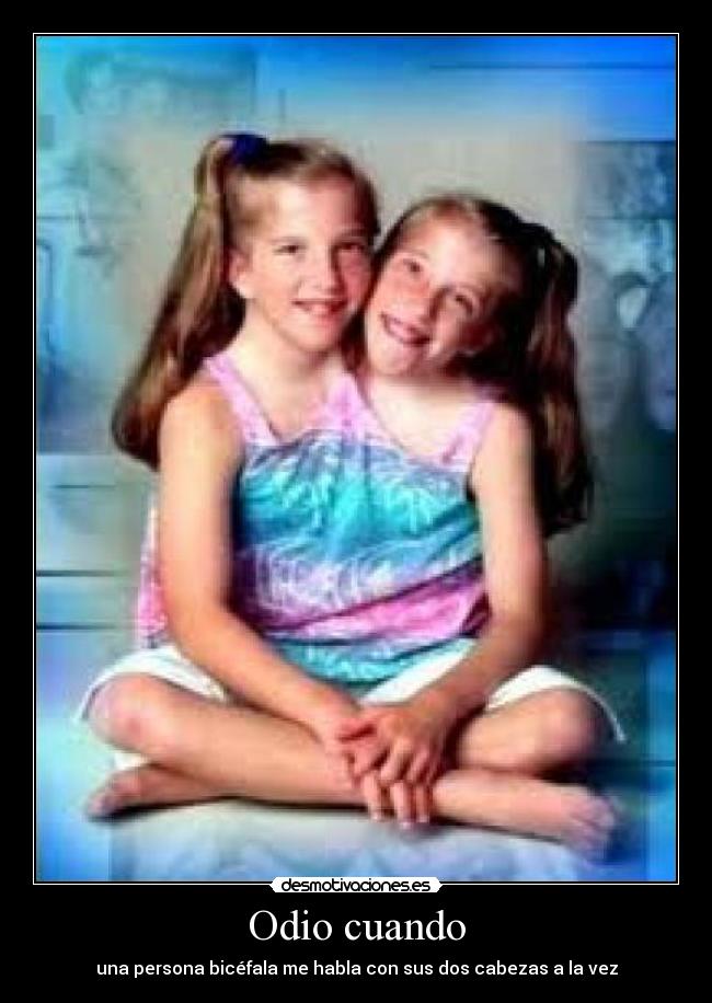 Odio cuando - una persona bicéfala me habla con sus dos cabezas a la vez