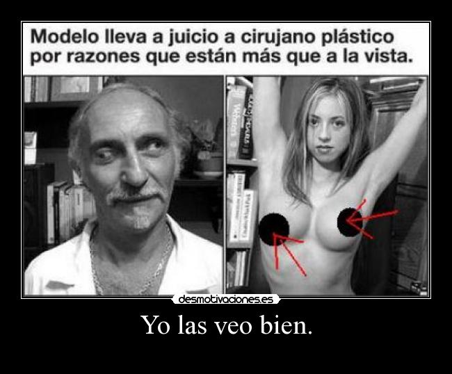 Yo las veo bien. - 