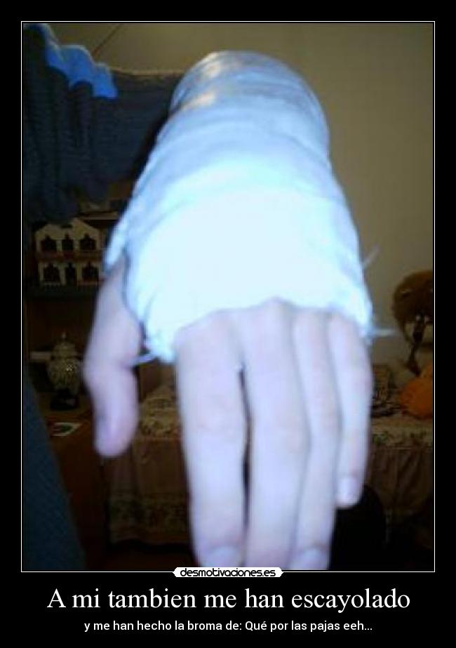A mi tambien me han escayolado - 