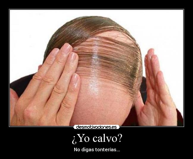 ¿Yo calvo? - No digas tonterías...