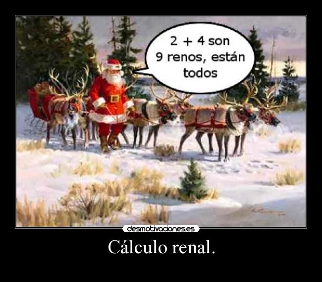 Cálculo renal. -