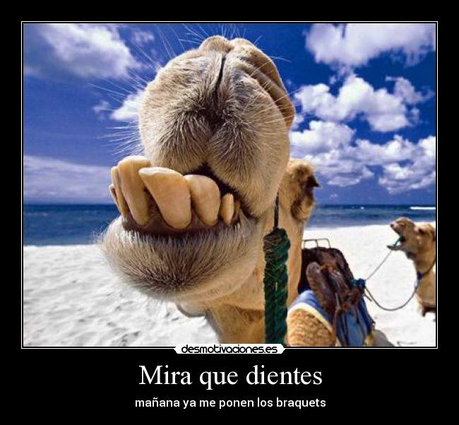Mira que dientes - mañana ya me ponen los braquets