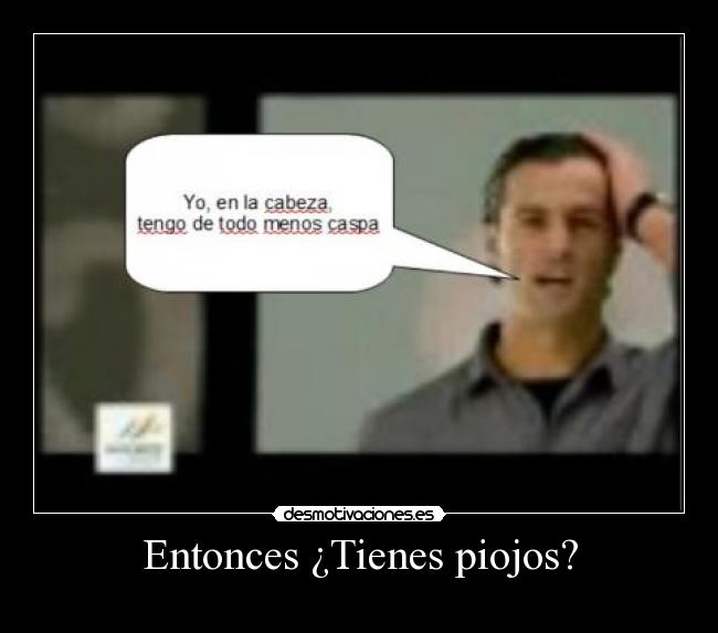 Entonces ¿Tienes piojos? -