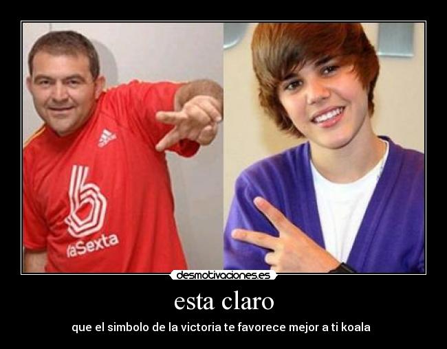 esta claro - que el simbolo de la victoria te favorece mejor a ti koala  