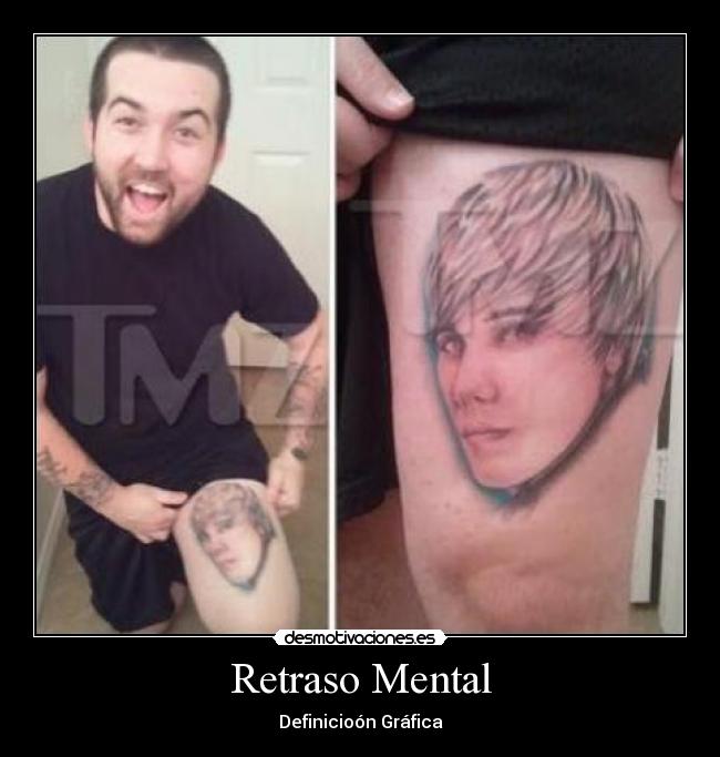Retraso Mental -