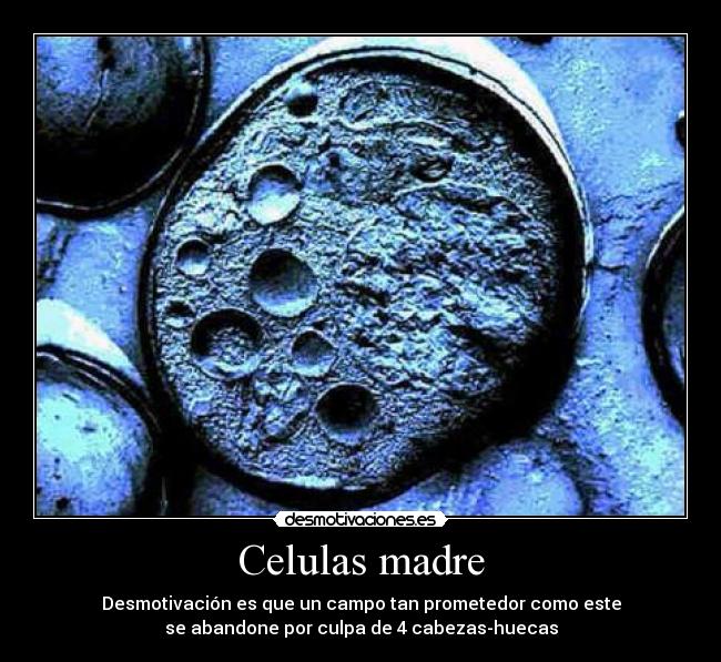 Celulas madre - Desmotivación es que un campo tan prometedor como este
se abandone por culpa de 4 cabezas-huecas