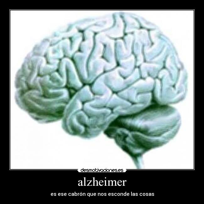 alzheimer - 