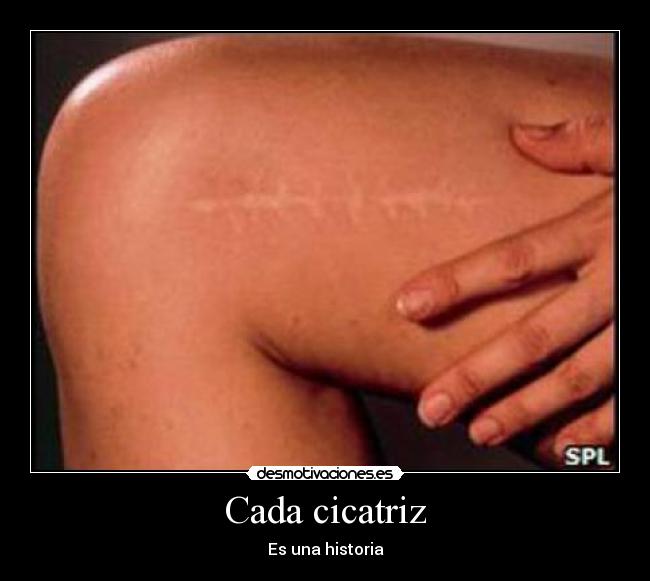 Cada cicatriz - 