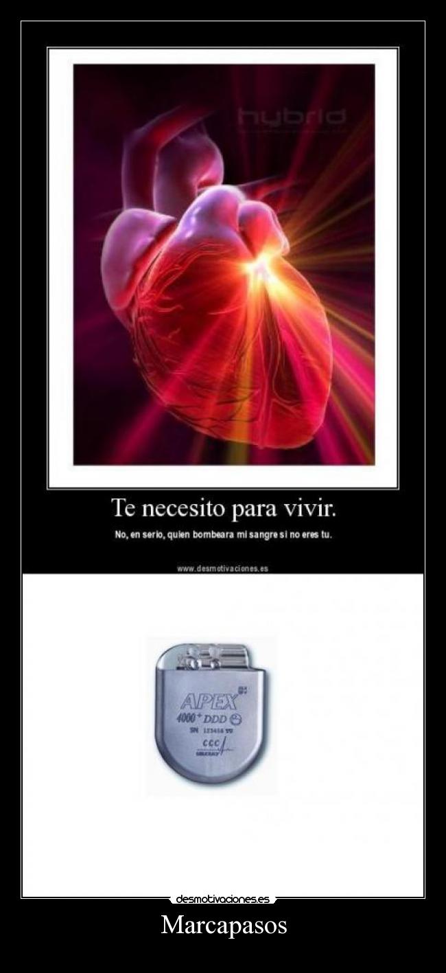 Marcapasos -