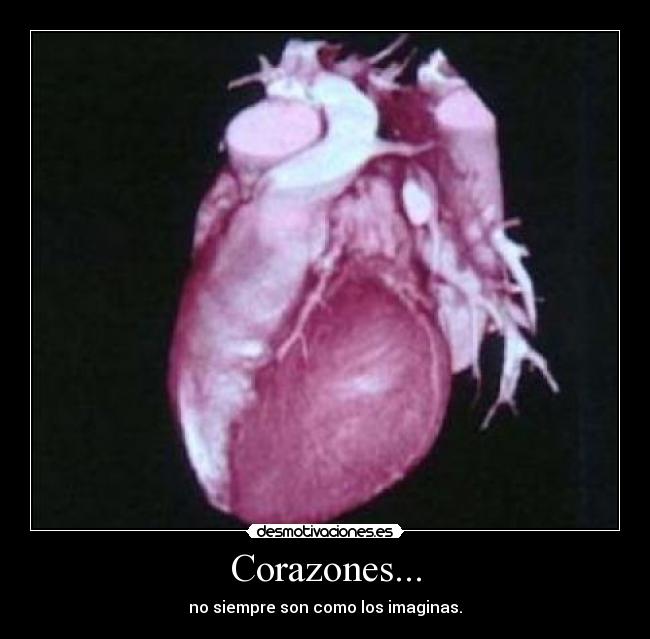 Corazones... - no siempre son como los imaginas.