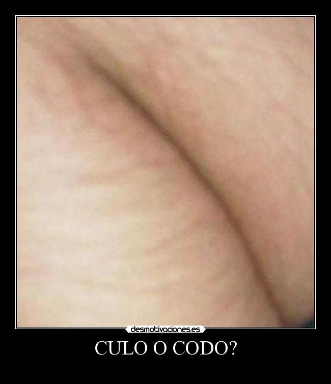 CULO O CODO? -