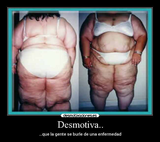 Desmotiva.. - ...que la gente se burle de una enfermedad