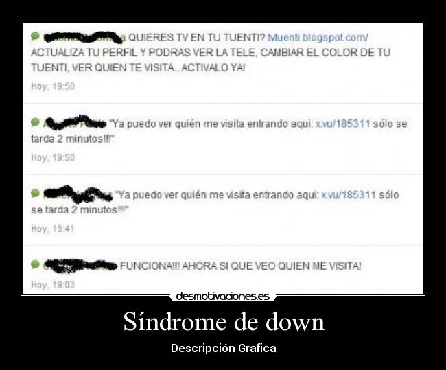 Síndrome de down - Descripción Grafica