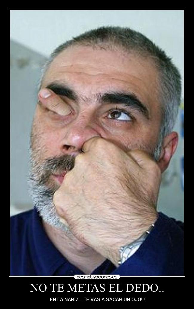 NO TE METAS EL DEDO.. - EN LA NARIZ... TE VAS A SACAR UN OJO!!!